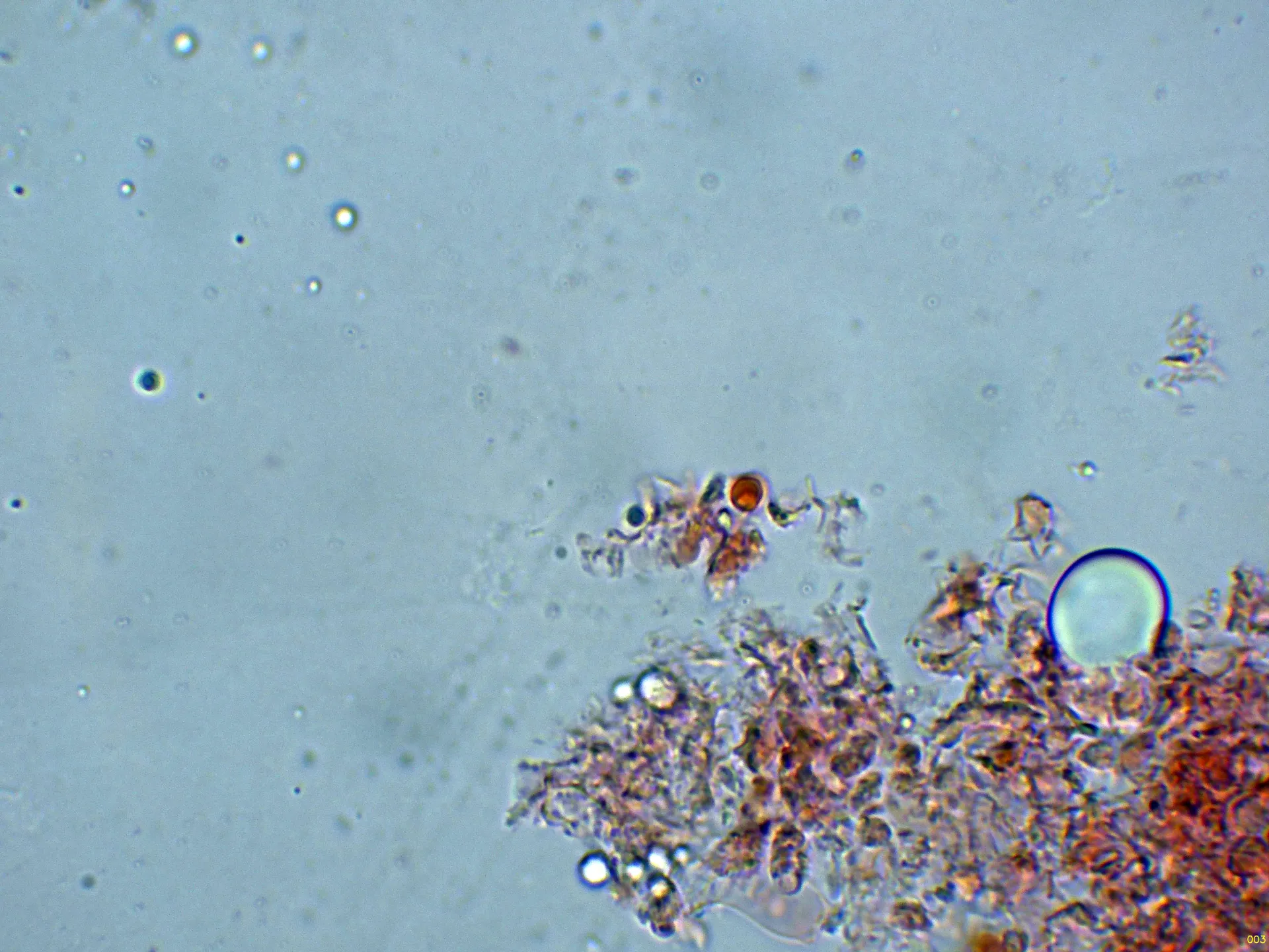 Microscopía de Xenasmatella ardosiaca - 10 - Hifas ramificadas-003